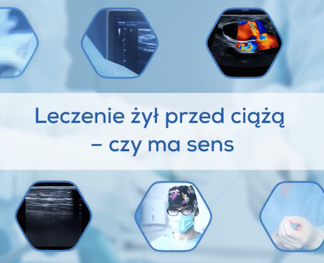 Leczenie żył przed ciążą - czy ma sens? 