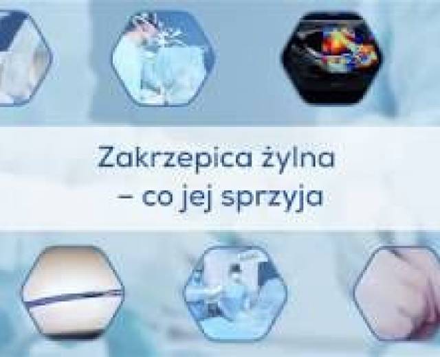 Zakrzepica żylna - co jej sprzyja?